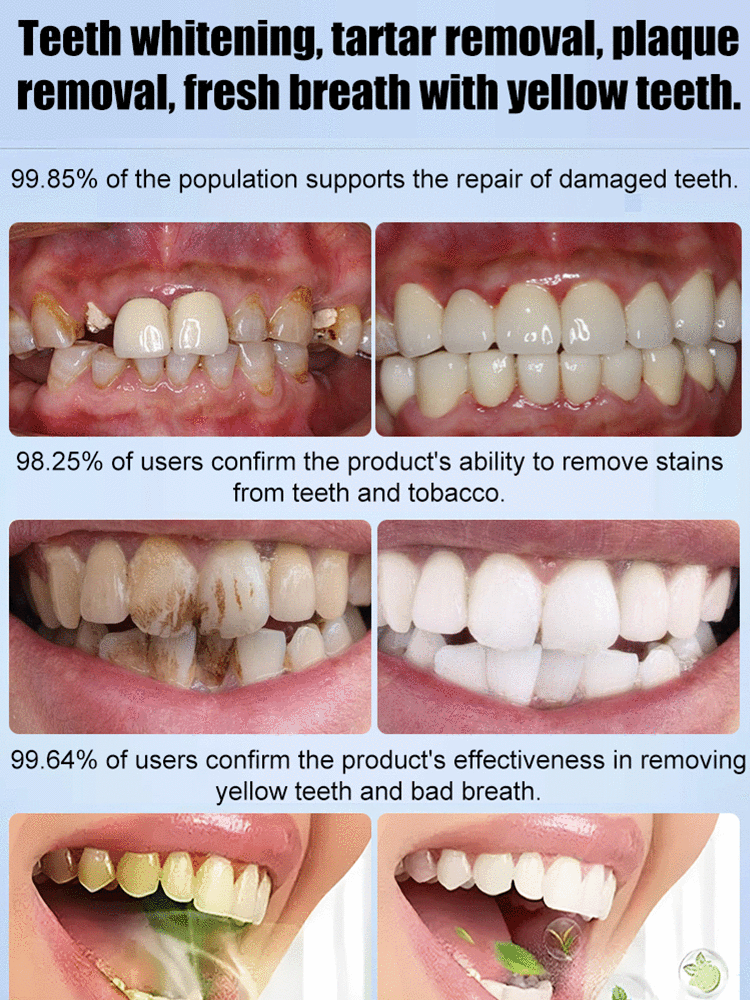 🖤2026 New Year · 40% OFF🖤Medical Grade Recombinant Oral Repair Mousse-4