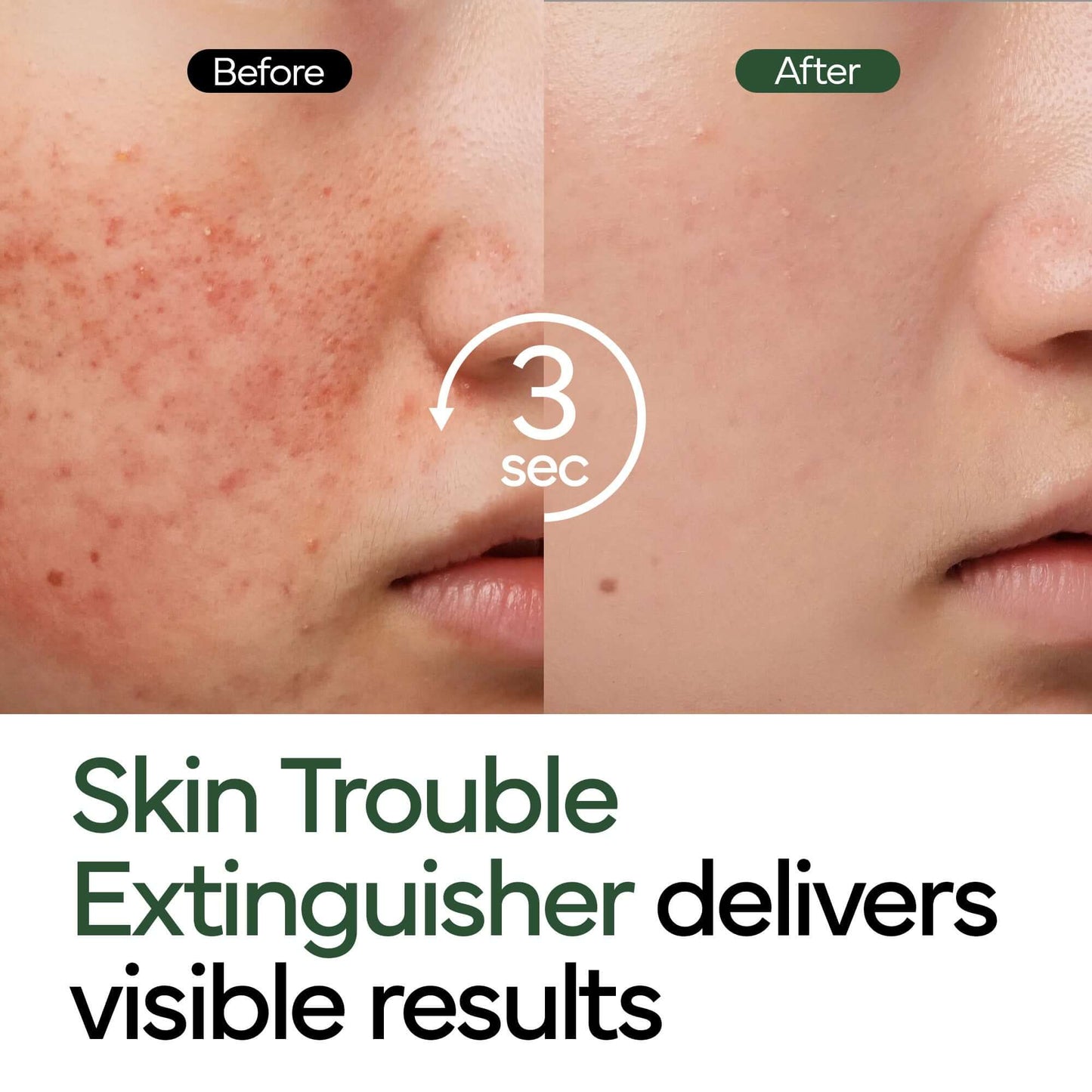 Intensive Cica Repair Cream-2