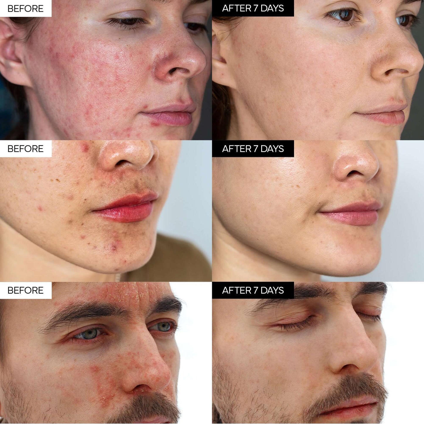Intensive Cica Repair Cream-5