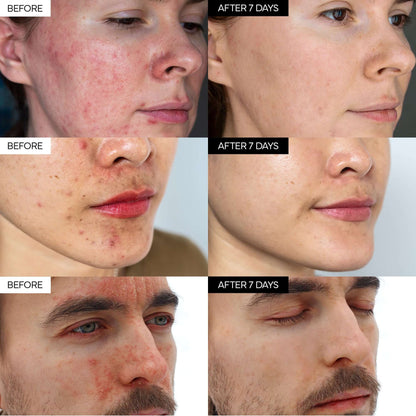 Intensive Cica Repair Cream-5