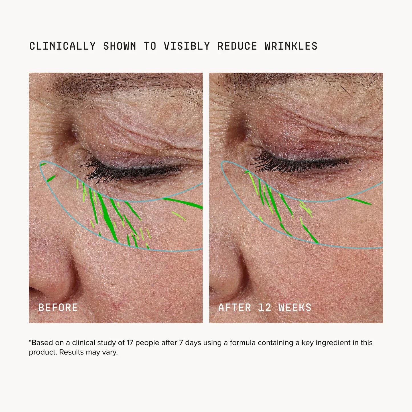 Needle-less® Growth Factor Serum