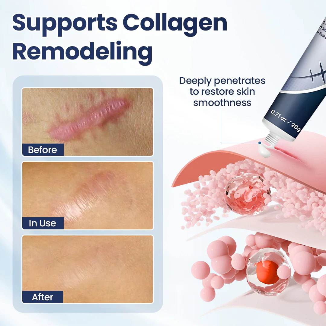 𝑶𝒇𝒇𝒊𝒄𝒊𝒂𝒍 𝑺𝒕𝒐𝒓𝒆 | LBMLBM® Texture Repair Gel — Say Goodbye to Stubborn Scars & Uneven Texture in 4 Weeks-3