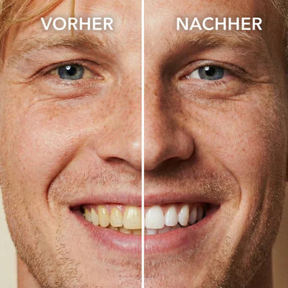 🖤2026 New Year · 40% OFF🖤Tooth Polish - Instant Clean Smile-1