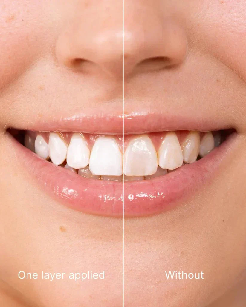 🖤2026 New Year · 40% OFF🖤Tooth Polish - Instant Clean Smile-5