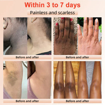 🔥Orange Enzyme Exfoliating Gel — The Gentle Miracle Your Skin Has Been Crying Out For-8