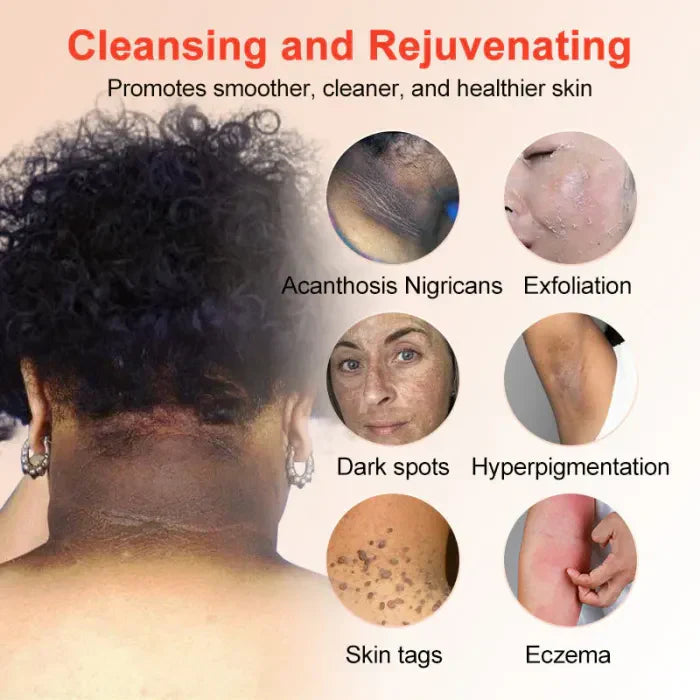 🔥Orange Enzyme Exfoliating Gel — The Gentle Miracle Your Skin Has Been Crying Out For-9