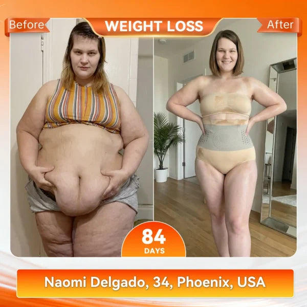 🥳2026 HOT SALE🥳💞80K+ SOLD!🌸🧘‍♀️ 40% OFF! Thermogenic Tummy Control Shorts – 30‑min daily wear, activates warmth & boosts circulation. Supports firmer, smoother contour. No gym needed. A smart shapewear choice. 👵✨-1
