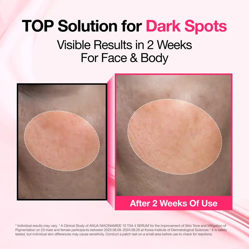 [Anua] Dark Spot Correcting Serum : 10% Niacinamide+ 4% Tranexamic Acid｜Niacinamide Serum, PM Skincare product, Hyperpigmentation, Brightening-6