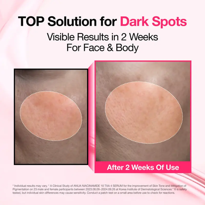 [Anua] Dark Spot Correcting Serum : 10% Niacinamide+ 4% Tranexamic Acid｜Niacinamide Serum, PM Skincare product, Hyperpigmentation, Brightening-6