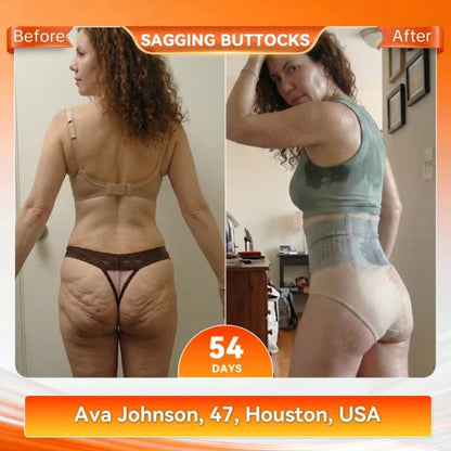 🥳2026 HOT SALE🥳💞80K+ SOLD!🌸🧘‍♀️ 40% OFF! Thermogenic Tummy Control Shorts – 30‑min daily wear, activates warmth & boosts circulation. Supports firmer, smoother contour. No gym needed. A smart shapewear choice. 👵✨-2