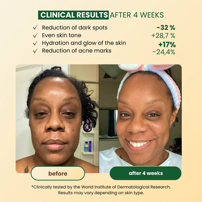 CuraGlow Anti-Spots & Hyperpigmentation Soap-7