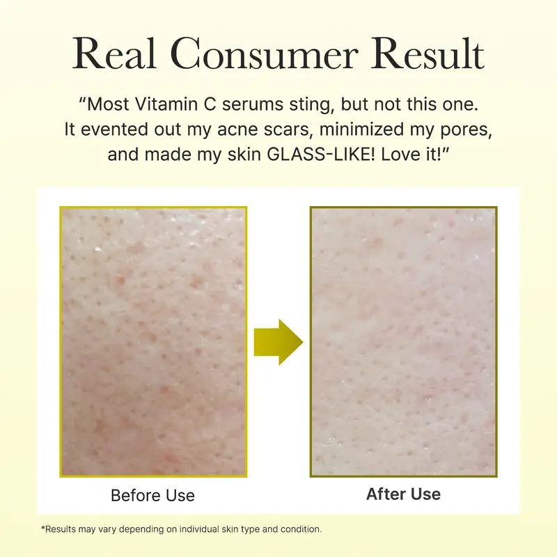 Vitamin C Booster Shot, Pure Vitamin C + Glutathione for Bright, Healthy Skin Glow-7