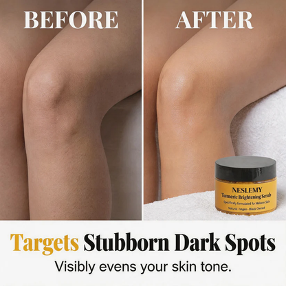 🏆 LIMITED-TIME 40% OFF! ✨Turmeric Exfoliating Body ScrubTurmeric Exfoliating Body Scrub