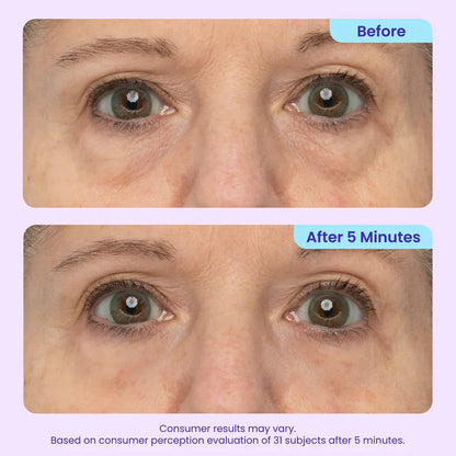 Final 3 Hours: 40%OFF🔥 Instant Lift Eye Gel for Puffiness, Bags & Dark Circles-5