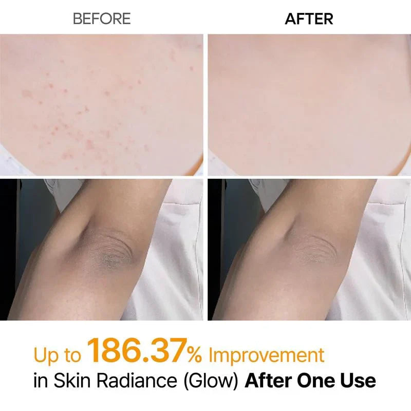 Shot Keratin Care Kojic Acid Turmeric Spray-1