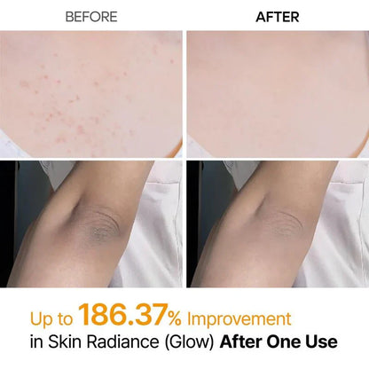 Shot Keratin Care Kojic Acid Turmeric Spray-1