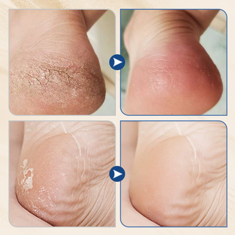 Hydrating and Anti-Cracking Foot Cream-2