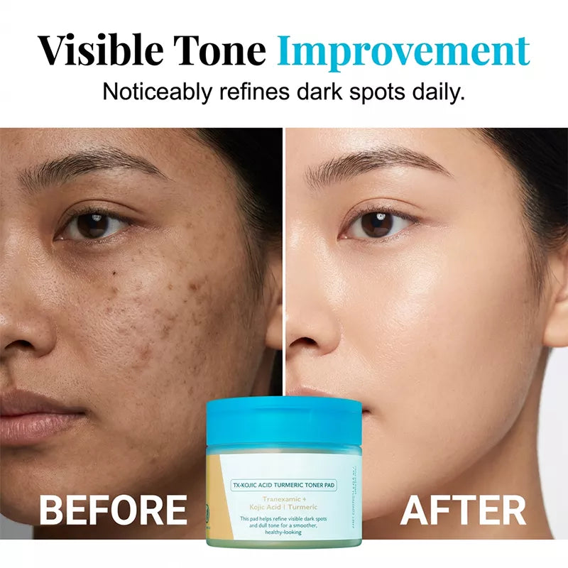 Kojic Acid Turmeric TX Toner Pad 70pads, Dark Spot & Pigmentation Care for Uneven Skin Tone-2
