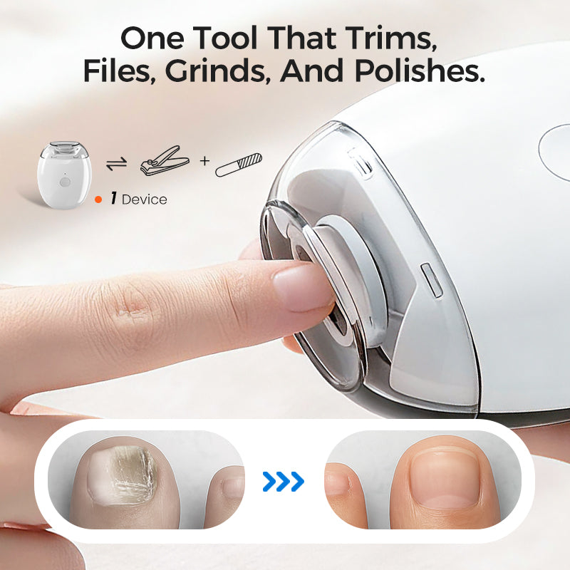 ⚡50K+ SOLD!🔥Universal Automatic Fingernail Grinder-2