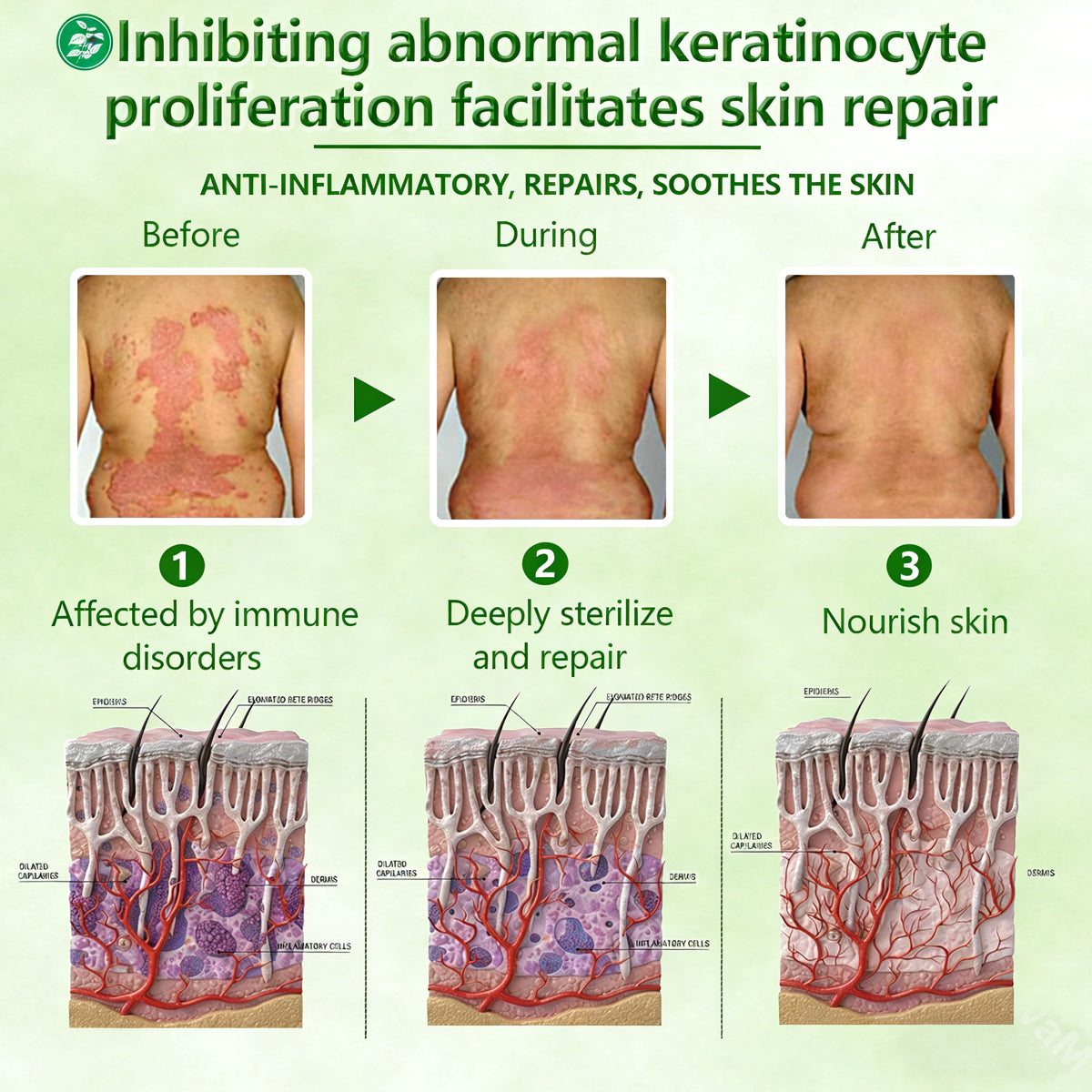 🔥Limited-Time Offer Herbal Miracle Cream for Stubborn Skin Issues-6
