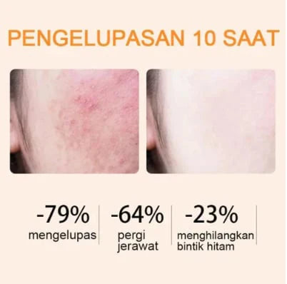 🔥Orange Enzyme Exfoliating Gel — The Gentle Miracle Your Skin Has Been Crying Out For-4