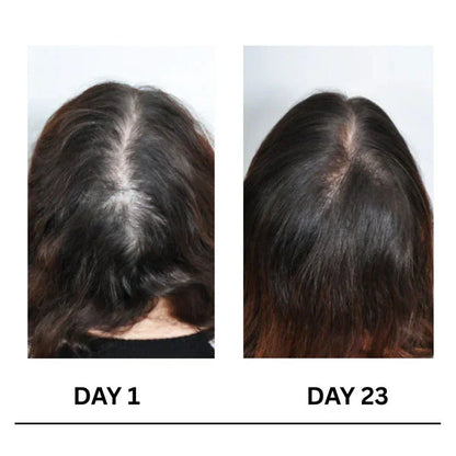🔥Limited-Time Offer Scalpy Boost+ Hair Growth-4