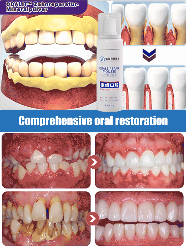 🖤2026 New Year · 40% OFF🖤Medical Grade Recombinant Oral Repair Mousse-1