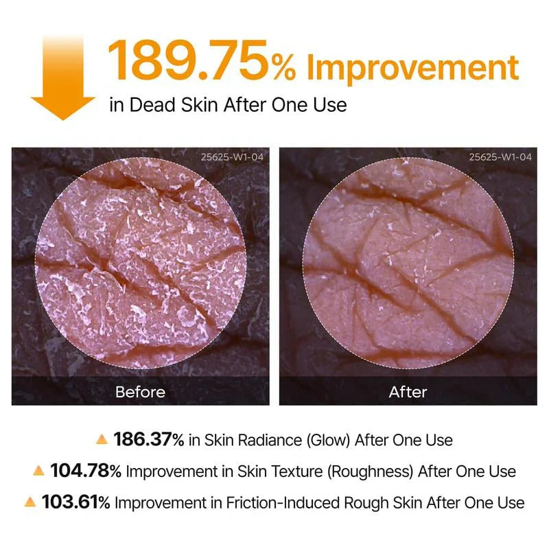 Shot Keratin Care Kojic Acid Turmeric Spray-4