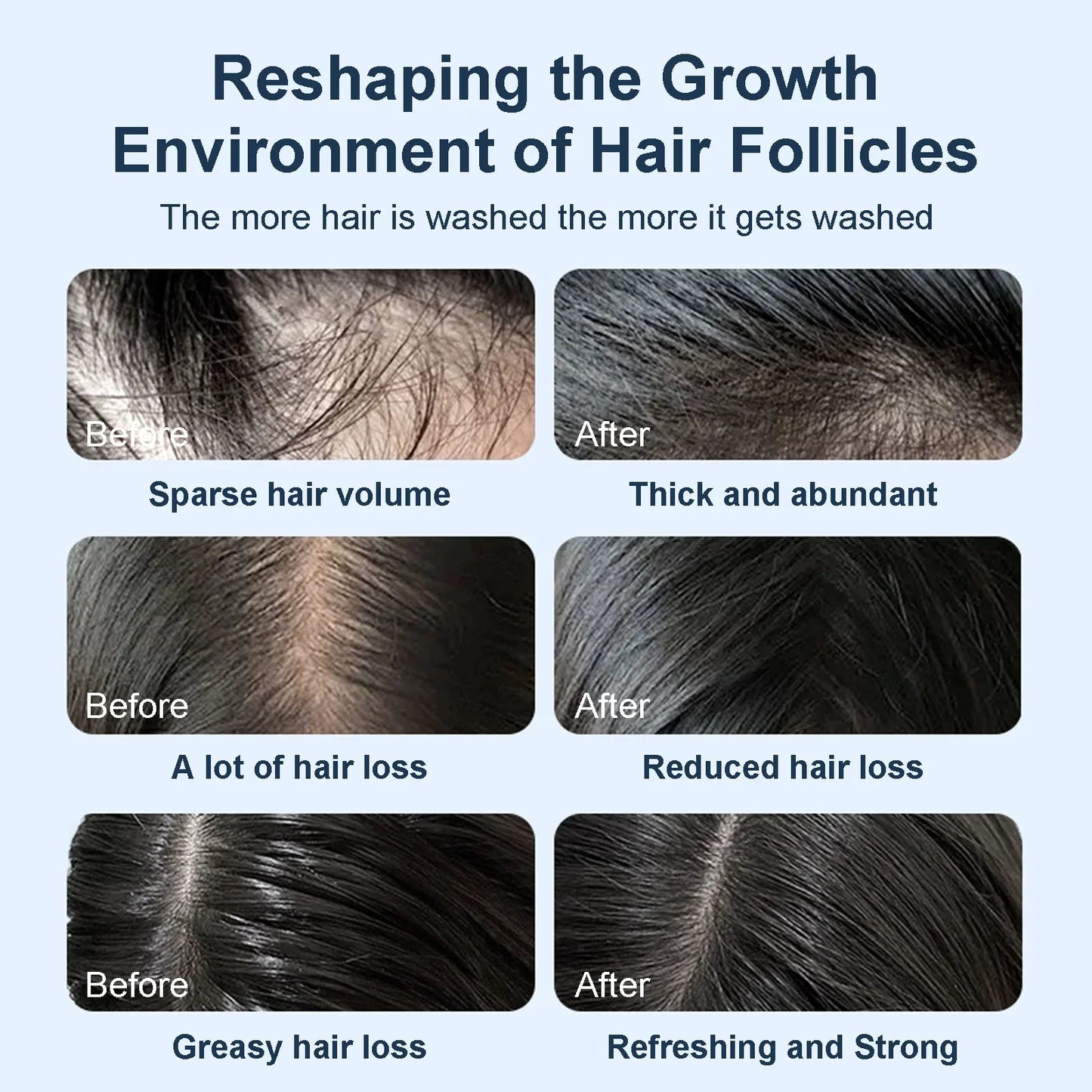 Tgideas Rosemary Shampoo-6