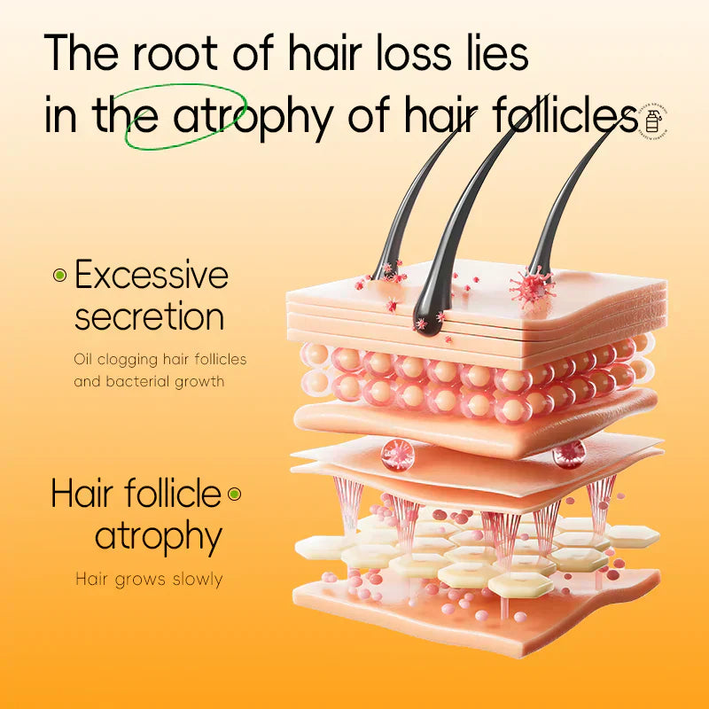 Anti-Hair Loss Shampoo-4