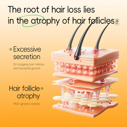 Anti-Hair Loss Shampoo-4