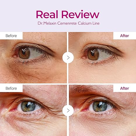 Dr.Melaxin Calcium Volume Eye Patches – Firming Hydrogel Under Eye Masks for Puffiness Fine Lines, Deep Hydration-5