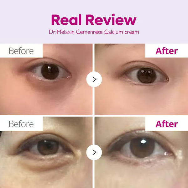 🖤2026 New Year · 40% OFF🖤Calcium Concentrated Repair Cream-2