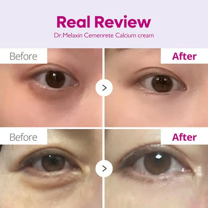 🖤2026 New Year · 40% OFF🖤Calcium Concentrated Repair Cream-2