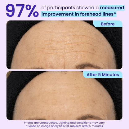 Final 3 Hours: 40%OFF🔥 Instant Lift Eye Gel for Puffiness, Bags & Dark Circles-6