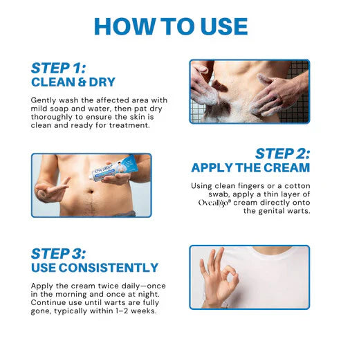 ⏰LIMIT TIME FREE SHIPPING✅🏆SOUTH MOON Gentle Cleansing Skin Blemish Topical Cream-6