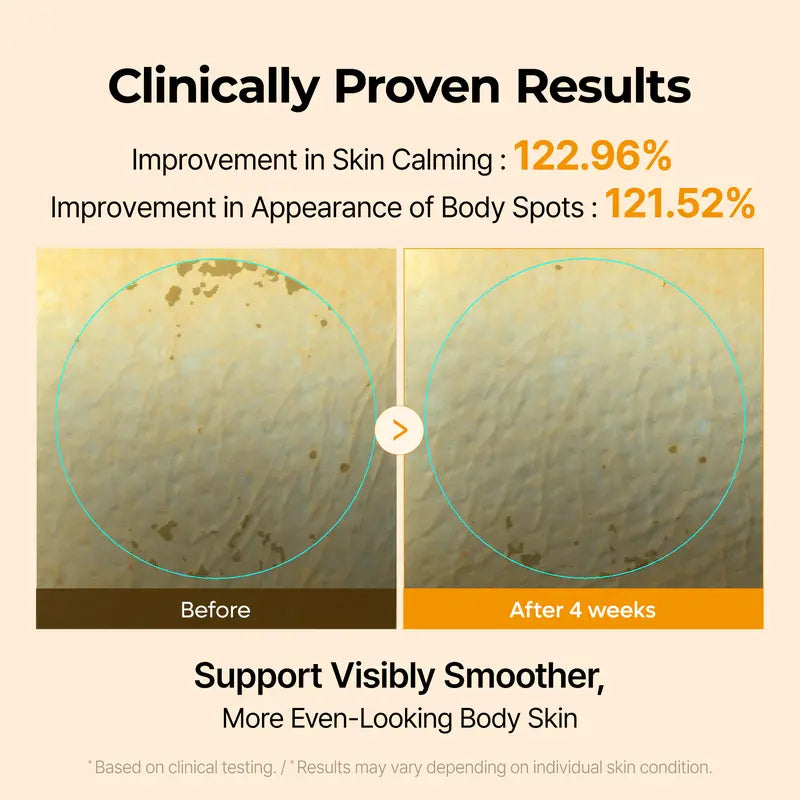 [Dr.melaxin Official] Kojic Acid Turmeric Capsule Body Cream for Body Dark Spot & Uneven Tone Care-5