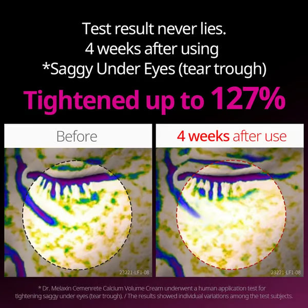 🖤2026 New Year · 40% OFF🖤Calcium Concentrated Repair Cream-3