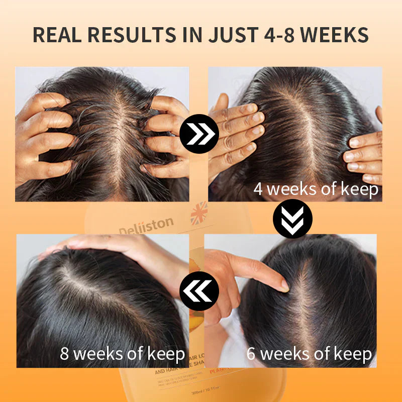 Anti-Hair Loss Shampoo-3