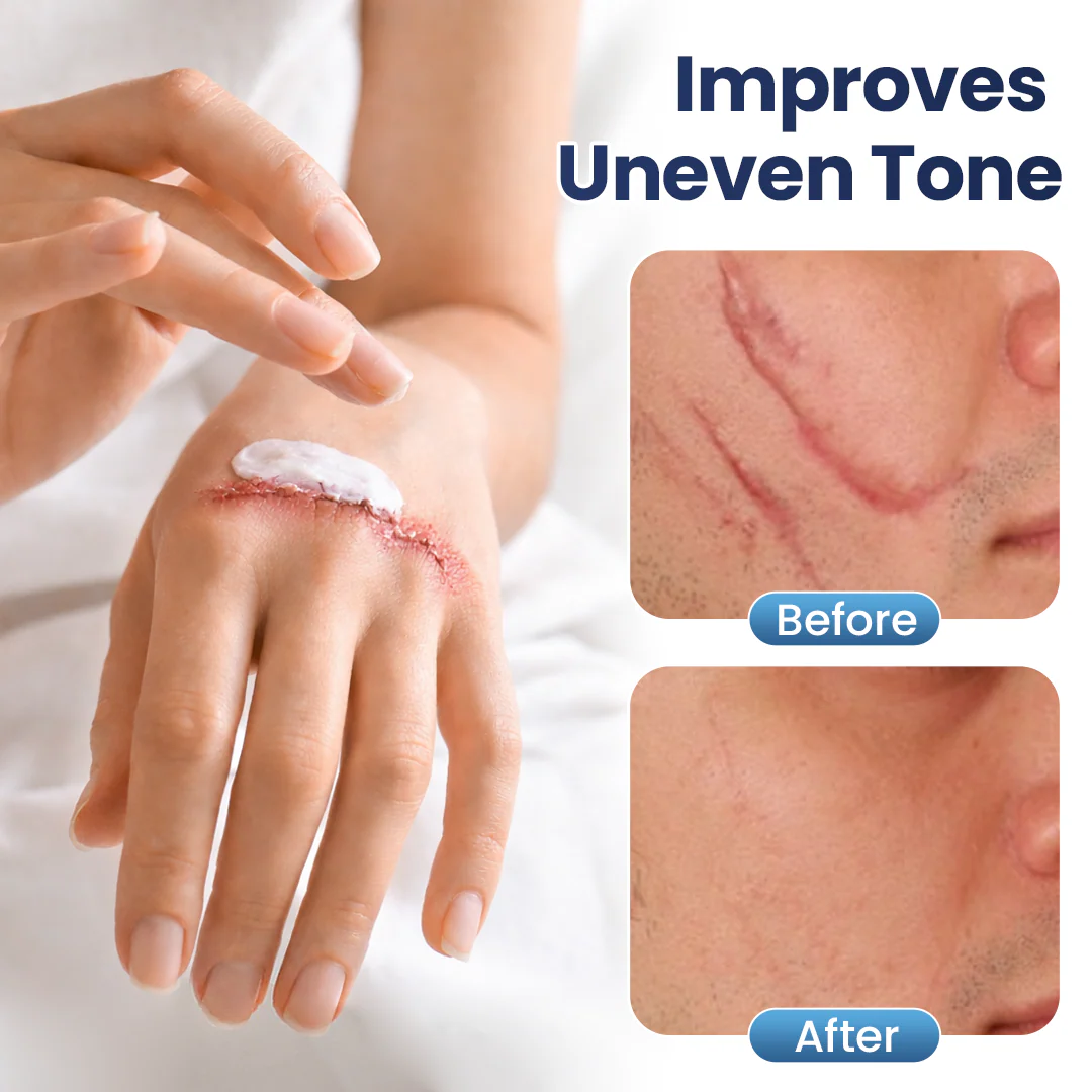 𝑶𝒇𝒇𝒊𝒄𝒊𝒂𝒍 𝑺𝒕𝒐𝒓𝒆 | LBMLBM® Texture Repair Gel — Say Goodbye to Stubborn Scars & Uneven Texture in 4 Weeks-5