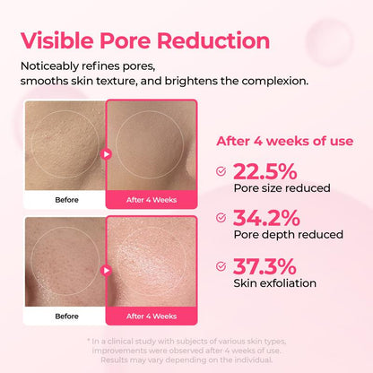 [Dr.Melaxin Official Shop]Lumi Pore & Spot Care Duo | Shrinks Pores & Fades Blemish Marks | Cyano Pink Spicule Serum + Picotonic Shot Ampoule-6