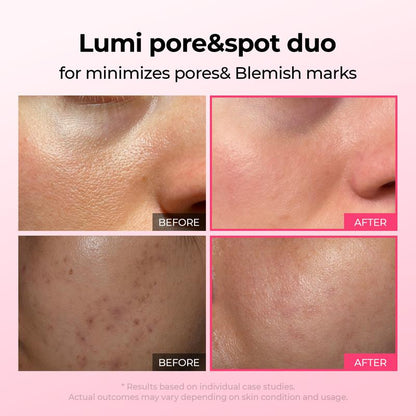 [Dr.Melaxin Official Shop]Lumi Pore & Spot Care Duo | Shrinks Pores & Fades Blemish Marks | Cyano Pink Spicule Serum + Picotonic Shot Ampoule-2