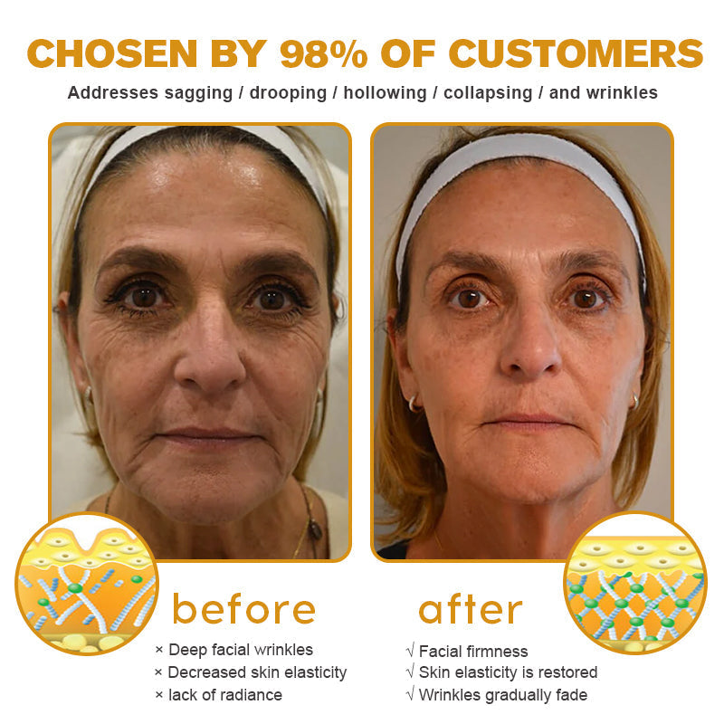 🖤2026 New Year · 40% OFF🧑‍⚕️TLOPA® Botox Bee Venom Wrinkle Removal Cream-3