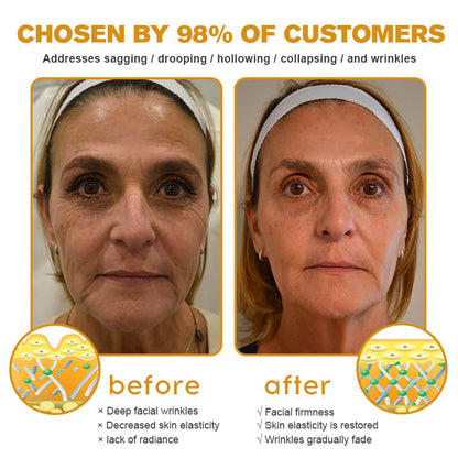 🖤2026 New Year · 40% OFF🧑‍⚕️TLOPA® Botox Bee Venom Wrinkle Removal Cream-3