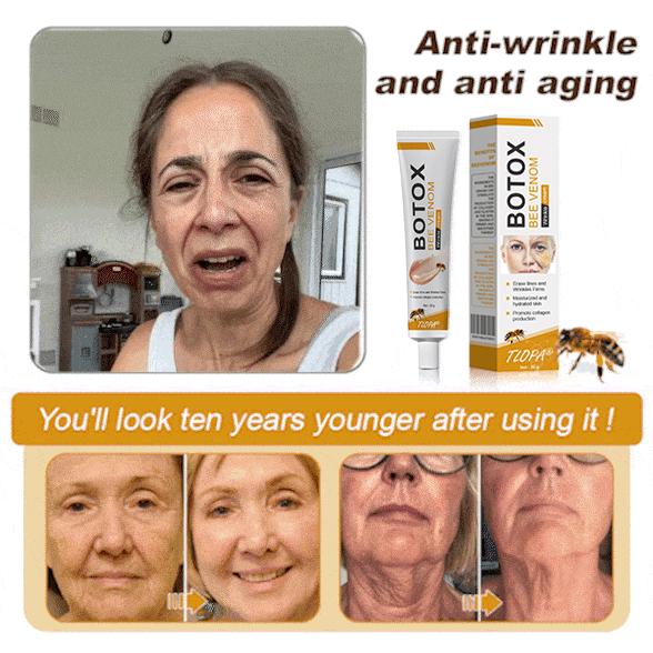 🖤2026 New Year · 40% OFF🧑‍⚕️TLOPA® Botox Bee Venom Wrinkle Removal Cream-6