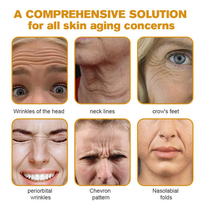 🖤2026 New Year · 40% OFF🧑‍⚕️TLOPA® Botox Bee Venom Wrinkle Removal Cream-1