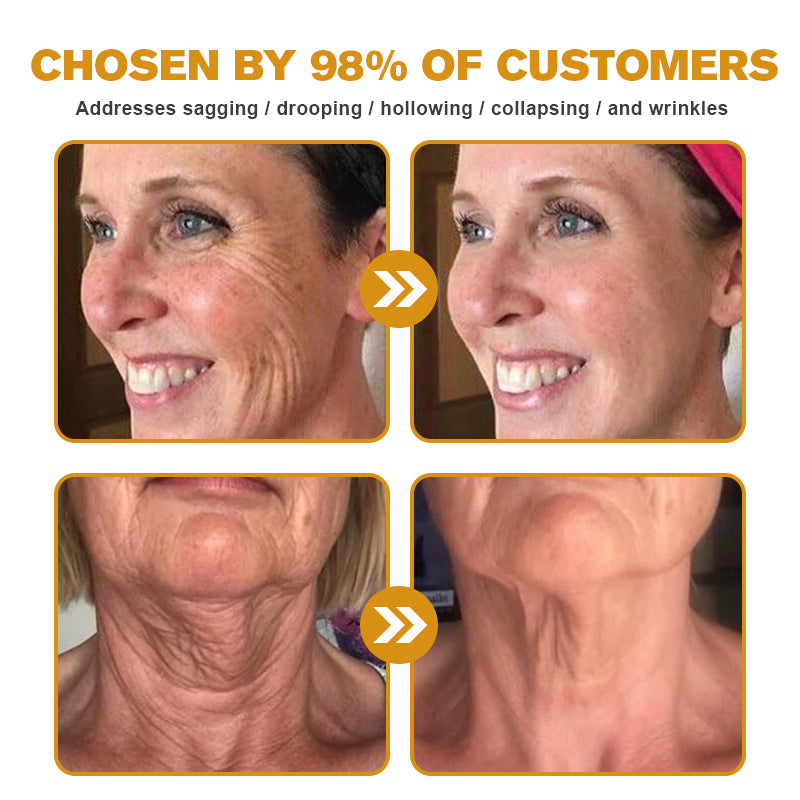 🖤2026 New Year · 40% OFF🧑‍⚕️TLOPA® Botox Bee Venom Wrinkle Removal Cream-2