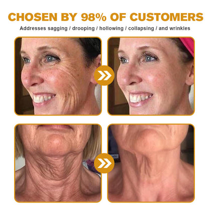 🖤2026 New Year · 40% OFF🧑‍⚕️TLOPA® Botox Bee Venom Wrinkle Removal Cream-2