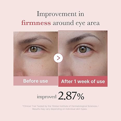 New Mix & Match Eye Serum Set👀–Advanced Anti-Aging, Reduce Lines & Firm Under-Eye Skin🌿-1