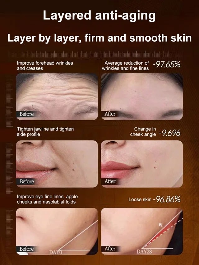 【One touch to remove wrinkles】Micro-molecular collagen anti-wrinkle lotion-1